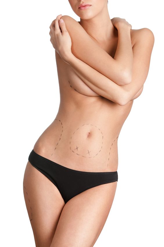 Liposuction Trends