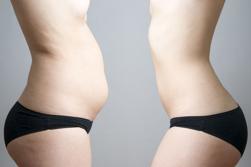 How SculpSure Body Contouring Can Boost Your Self-Esteem