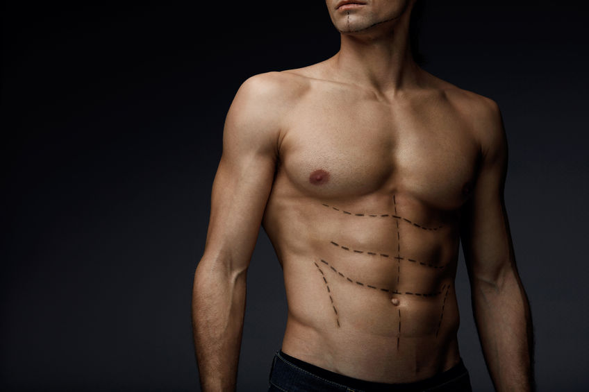 Liposuction For Men