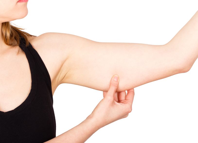 Arm Fat Liposuction